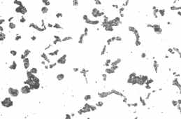 Structure d'une fonte  graphite sphrodal